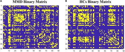 Reorganization of the Brain Structural Covariance Network in Ischemic Moyamoya Disease Revealed by <mark class="highlighted">Graph Theoretical Analysis</mark>